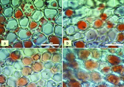 oleosomes under microscope with sudan iii